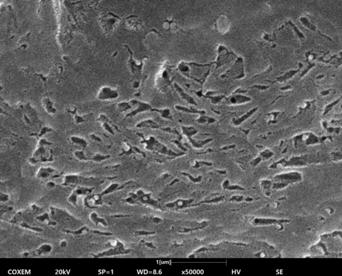 Permernent tooth (18)